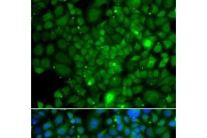 Immunofluorescence analysis of A549 cells using RRAGA Polyclonal Antibody (RRAGA 抗体)