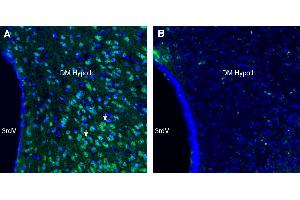 Immunohistochemical staining of perfusion-fixed frozen mouse brain sections with Anti-GPR75 Antibody (ABIN7884993), (1:300), followed by goat anti-rabbit-.