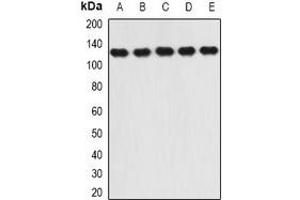 Western blot analysis of RANBP5 expression in SW620 (A), Hela (B), HepG2 (C), mouse heart (D), mouse brain (E) whole cell lysates. (Importin 5 抗体)