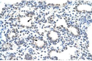 Immunohistochemistry (IHC) image for anti-Zinc Finger Protein 265 (Zranb2) (Isoform 2), (Middle Region) antibody (ABIN1449802)
