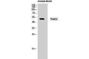 anti-TEA Domain Family Member 2 (TEAD2) (AA 40-120) antibody