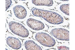 IHC analysis of COMT using anti-COMT antibody (ABIN7601948).