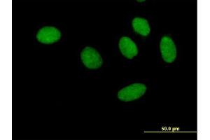 Immunofluorescence (IF) image for anti-General Transcription Factor IIF, Polypeptide 1, 74kDa (GTF2F1) (AA 1-517) antibody (ABIN947944)