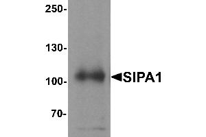 Western blot analysis of SIPA1 in human brain tissue lysate with SIPA1 antibody at 1 µg/mL.