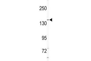Western blot analysis of NIK antibody and Jurkat lysate. (MAP4K4 抗体  (AA 618-649))