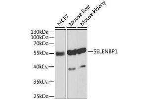 Western Blotting (WB) image for anti-Selenium Binding Protein 1 (SELENBP1) (AA 243-472) antibody (ABIN3021767)