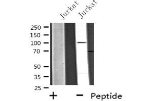 Western blot analysis of extracts from 293 cells, using USP11 antibody. (USP11 抗体  (Internal Region))
