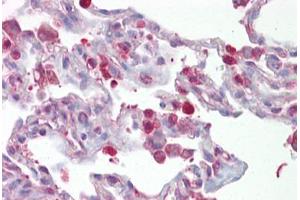 Anti-FOSL1 / FRA1 antibody IHC staining of human lung. (FOSL1 抗体  (AA 143-192))