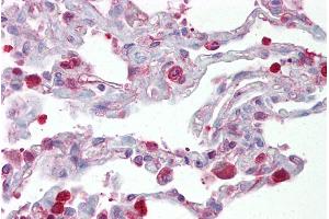 Immunohistochemistry with Lung tissue at an antibody concentration of 5µg/ml using anti-FOSL1 antibody (ARP31378_P050) (FOSL1 抗体  (Middle Region))