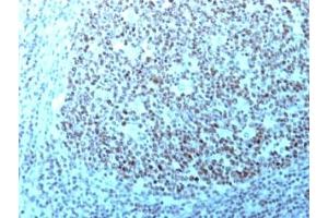 Formalin-fixed, paraffin-embedded human tonsil stained with Nucleolin antibody. (Nucleolin 抗体)