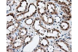 Immunohistochemical staining of paraffin-embedded Kidney tissue using anti-FAHD2Amouse monoclonal antibody. (FAHD2A 抗体)