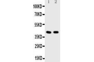 Observed bind size: 42KD (HDAC8 抗体  (N-Term))