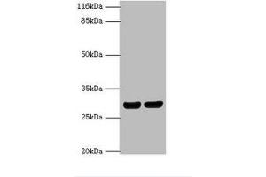 Western Blotting (WB) image for anti-Major Histocompatibility Complex, Class II, DR beta 1 (HLA-DRB1) (AA 30-266) antibody (ABIN6068471) (HLA-DRB1 抗体  (AA 30-266))