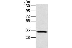 Western Blot analysis of Mouse lung tissue using STX11 Polyclonal Antibody at dilution of 1:400 (Syntaxin 11 抗体)