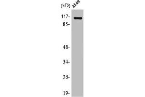 Western Blot analysis of HuvEc cells using Liprin β1 Polyclonal Antibody (PPFIBP1 抗体  (Internal Region))