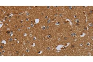 Immunohistochemistry of paraffin-embedded Human brain using PCK2 Polyclonal Antibody at dilution of 1:60 (PEPCK 抗体)