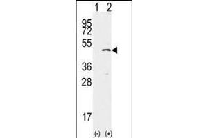 Western blot analysis of SET9(arrow) using rabbit polyclonal SET9 Antibody (ABIN387997 and ABIN2845289). (SETD7 抗体  (AA 159-189))
