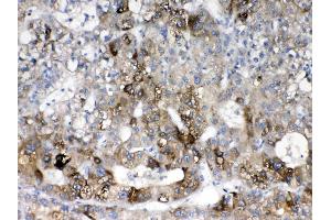Immunohistochemistry (IHC) image for anti-Cytochrome P450, Family 2, Subfamily D, Polypeptide 6 (CYP2D6) (AA 315-347), (C-Term) antibody (ABIN5518823)