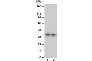 Western blot testing of Aquaporin 8 antibody and Lane 1:  SW620;  2: COLO320 cell lysate. (Aquaporin 8 抗体  (N-Term))