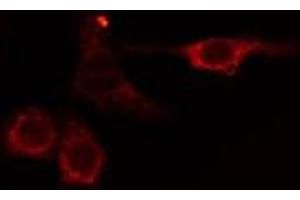 ABIN6275049 staining HuvEc cells by IF/ICC. (AGBL2 抗体  (C-Term))