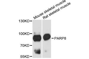 Western blot analysis of extracts of various cell lines, using PARP8 antibody. (PARP8 抗体)