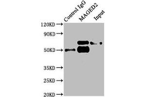 Immunoprecipitating MAGED2 in HepG2 whole cell lysate Lane 1: Rabbit control IgG instead of ABIN7159296 in HepG2 whole cell lysate. (MAGED2 抗体  (AA 38-285))