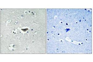 Immunohistochemical analysis of paraffin-embedded human brain tissue using Ras-GRF1 (Phospho-Ser916) antibody (left)or the same antibody preincubated with blocking peptide (right). (RASGRF1 抗体  (pSer916))