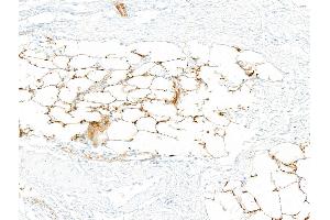 Immunohistochemistry (IHC) image for anti-CD36 (CD36) (AA 30-439) antibody (ABIN7449417) (Recombinant CD36 抗体  (AA 30-439))