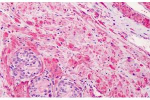 Human Prostate: Formalin-Fixed, Paraffin-Embedded (FFPE) (Vinculin 抗体)