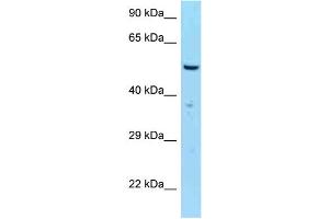 WB Suggested Anti-SASS6 Antibody Titration: 1. (SASS6 抗体  (C-Term))