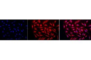 Immunocytochemistry/Immunofluorescence analysis using Rabbit Anti-GRP94 Polyclonal Antibody (ABIN1686652 and ABIN1686653). (GRP94 抗体  (C-Term))