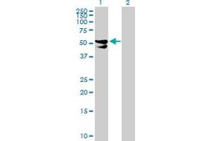 Western Blot analysis of PDP2 expression in transfected 293T cell line by PDP2 MaxPab polyclonal antibody. (PDP2 抗体  (AA 1-529))