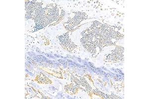 Immunohistochemistry analysis of paraffin-embedded mouse bone using Eif2ak1 (ABIN7073875) at dilution of 1: 1000 (EIF2AK1 抗体)