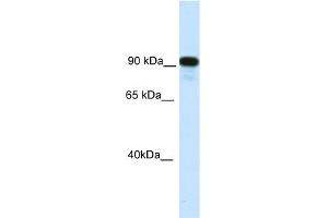 WB Suggested Anti-C2TA Antibody Titration:  0. (CIITA 抗体  (C-Term))