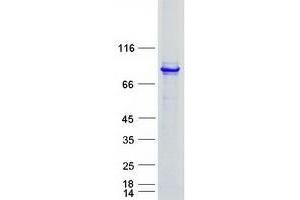 Western Blotting (WB) image for Thioredoxin Domain Containing 3 (TXNDC3) protein (Myc-DYKDDDDK Tag) (ABIN2734670)