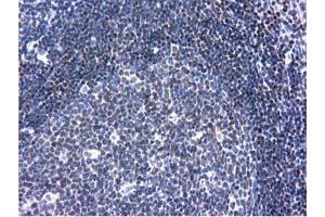 Immunohistochemical staining of paraffin-embedded Human lymph node tissue using anti-ANKRD53 mouse monoclonal antibody. (ANKRD53 抗体  (AA 1-300))