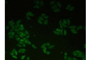 Detection of CTNNa1 in Human Hela Cells using Polyclonal Antibody to Catenin Alpha 1 (CTNNa1) (CTNNA1 抗体  (AA 2-228))