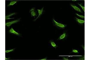 Immunofluorescence of monoclonal antibody to RBP7 on HeLa cell. (RBP7 抗体  (AA 35-134))