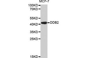Western blot analysis of extracts of MCF-7 cell line, using DDB2 antibody. (DDB2 抗体  (AA 1-315))