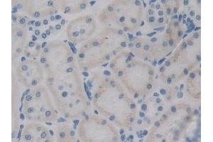 Immunohistochemistry (IHC) image for anti-Advanced Glycosylation End Product-Specific Receptor (AGER) (AA 180-402) antibody (ABIN7443794)