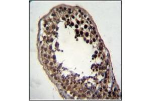Immunohistochemistry (Paraffin-embedded Sections) (IHC (p)) image for anti-Follistatin-Like 3 (Secreted Glycoprotein) (FSTL3) (AA 228-258), (C-Term) antibody (ABIN952356)