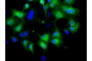 Anti-CRYM mouse monoclonal antibody (ABIN2452922) immunofluorescent staining of COS7 cells transiently transfected by pCMV6-ENTRY CRYM (RC218123). (CRYM 抗体)