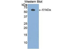 Western Blotting (WB) image for anti-Phospholipase A2-Activating Protein (PLAA) (AA 534-792) antibody (ABIN1860254) (PLAA 抗体  (AA 534-792))