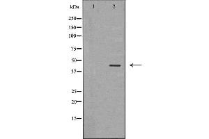 Western blot analysis of A549 whole cell lysates, using MICA Antibody. (MICA 抗体  (N-Term))