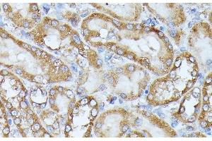 Immunohistochemistry of paraffin-embedded Rat kidney using HAL Polyclonal Antibody at dilution of 1:100 (40x lens). (HAL 抗体)
