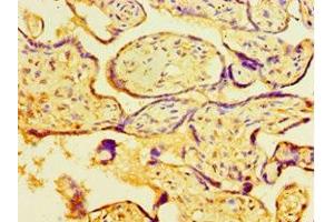 Immunohistochemistry (IHC) image for anti-DNA segment, Chr 17, Wayne State University 104, expressed (D17Wsu104e) (AA 32-173) antibody (ABIN7160486)