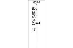 Western blot analysis of NCS1 Antibody in MCF-7 cell line lysates (35ug/lane) (NCS1 抗体  (AA 118-144))