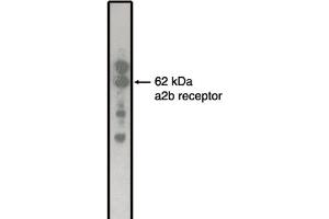 Western Blotting (WB) image for anti-Adrenergic, alpha-2B-, Receptor (ADRA2B) antibody (ABIN264463) (ADRA2B 抗体)