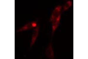ABIN6274094 staining 293 cells by IF/ICC. (KLF11 抗体  (N-Term))