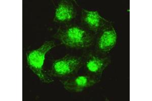 anti-Protein Phosphatase 4C antibody